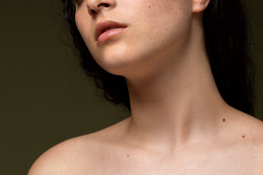 Alopecia frontal fibrosante